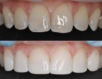 Open Late Dentistry and Orthodontics image 2
